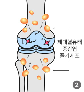 제대혈유래 중간엽 줄기세포